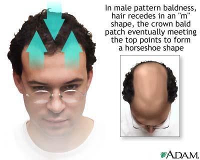 How To Sell Female Hair Loss 25 Years Old