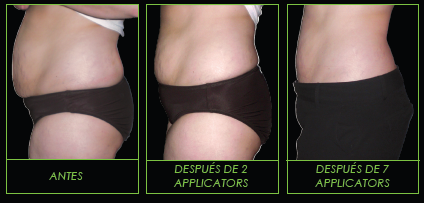 Tripa 7 aplicaciones photo Tripa_zpsb7b04662.png